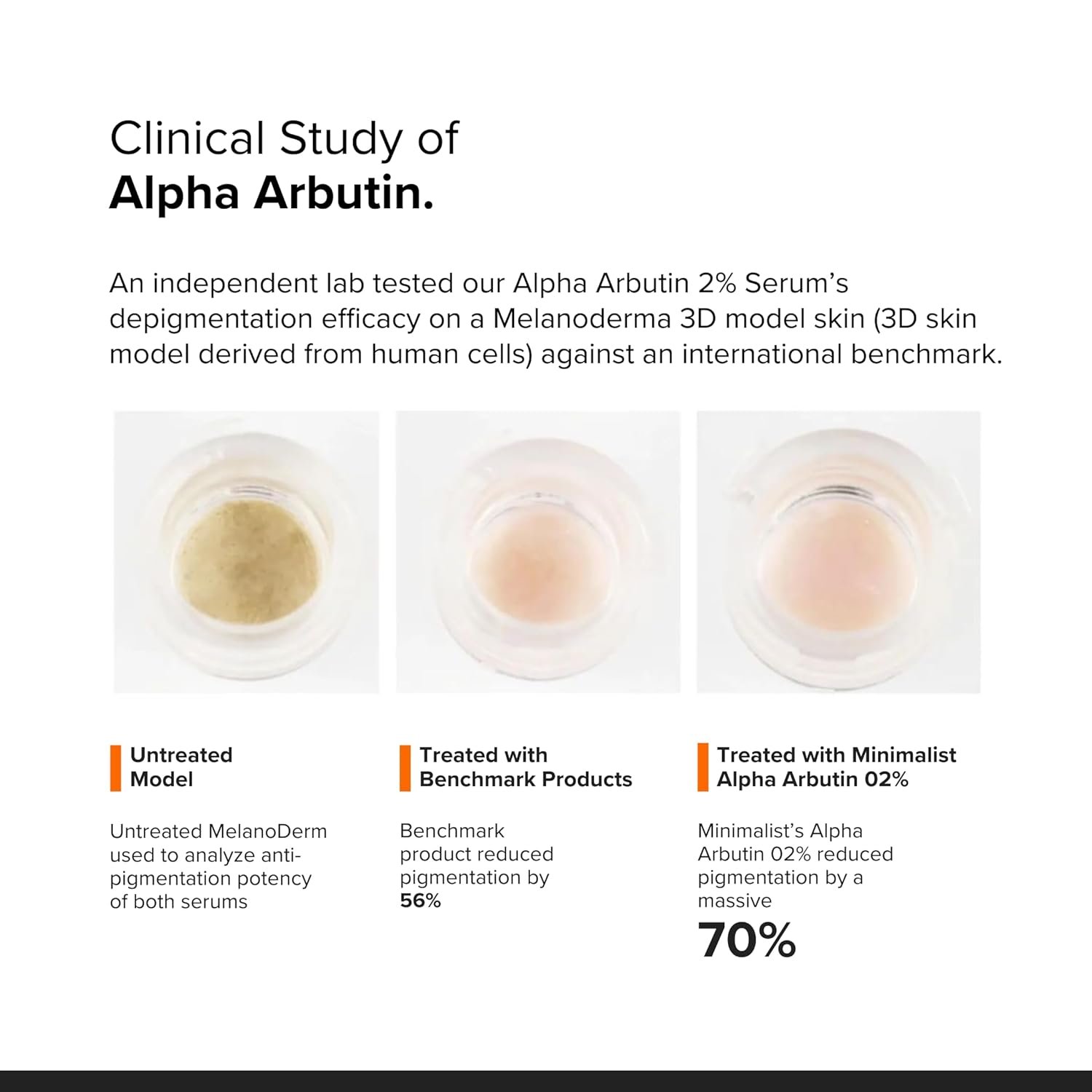 Minimalist 2% Alpha Arbutin Serum – Dark Spot & Hyperpigmentation Removal – 30ml - Image 6