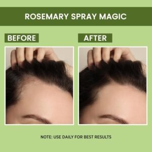 Alps Goodness Rosemary Water Spray – Hair Growth & Hairfall Control – 100ml