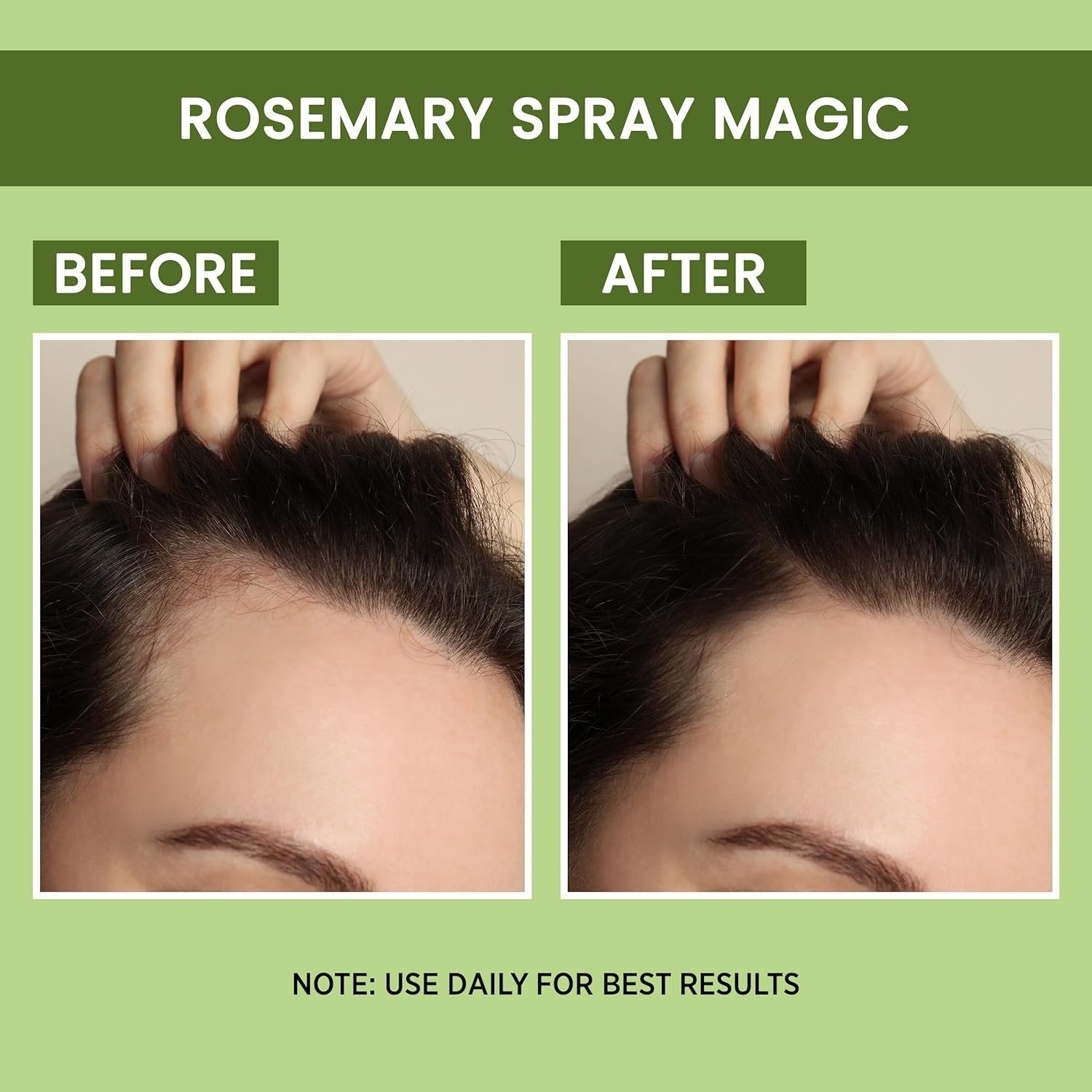 Alps Goodness Rosemary Water Spray – Hair Growth & Hairfall Control – 100ml - Image 4